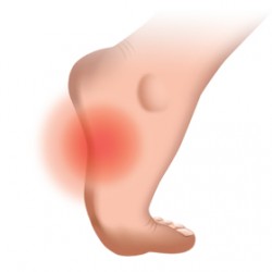 transverse arch pain in foot