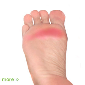 Foot Problems | Foot Pain