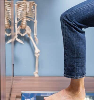 Lady having foot scan